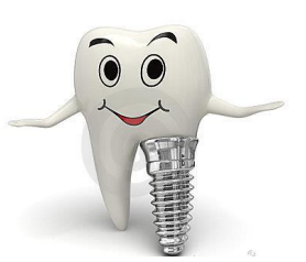 tooth implant in delhi