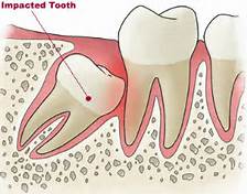 best_dental_clinic_in_ashok_vihar
