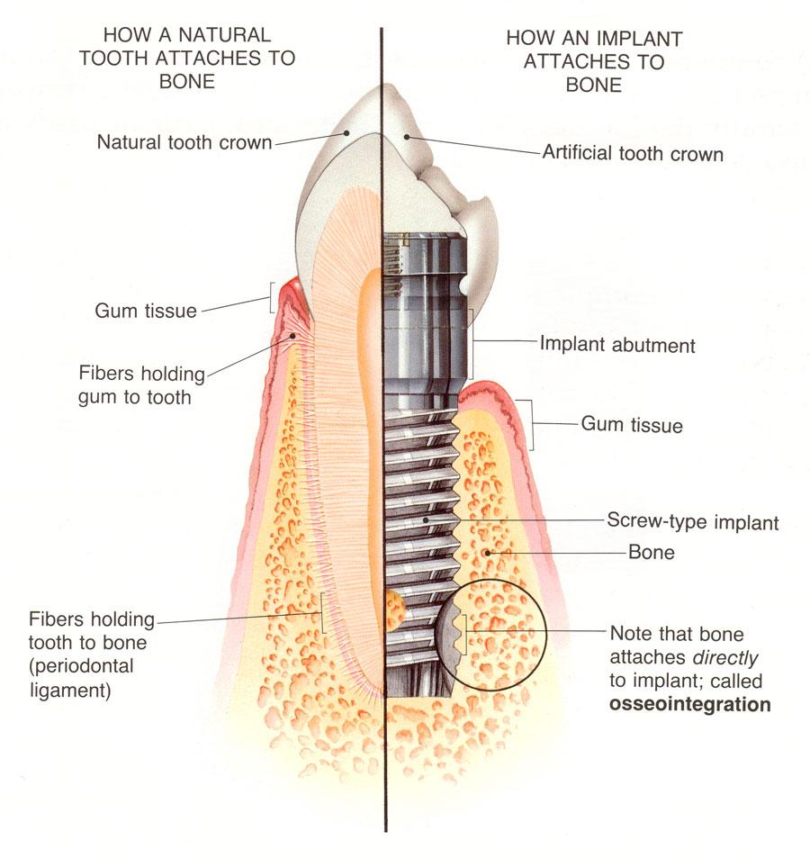 dental-implant-clinic