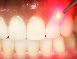effective tool in modern dentistry