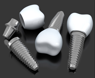 Effect of Osteoporosis on dental implants