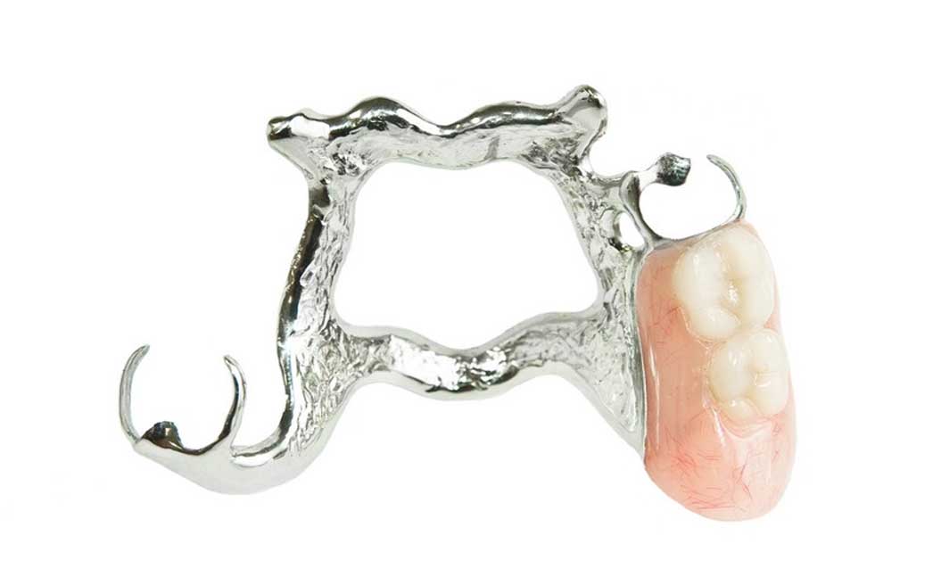 Cast Partial Denture